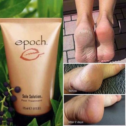 Sole Solution
